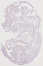 EMAGE:12694