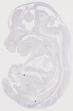 EMAGE:12694