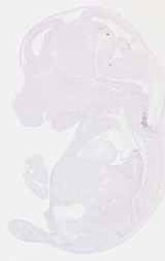 EMAGE:12752