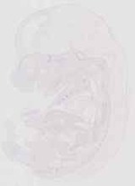 EMAGE:12755