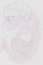 EMAGE:12755