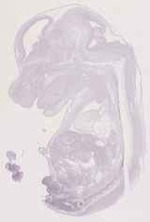 EMAGE:12764