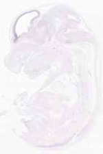 EMAGE:12794