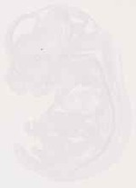 EMAGE:12814