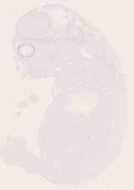 EMAGE:12814