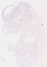 EMAGE:12818