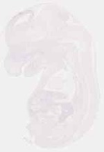 EMAGE:12819