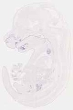 EMAGE:12881