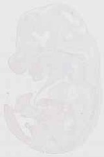 EMAGE:12903