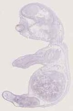 EMAGE:12944