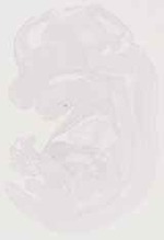EMAGE:12944