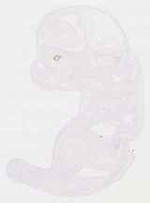 EMAGE:12949