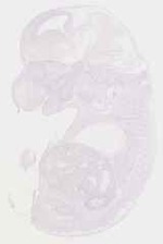 EMAGE:12949