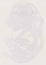 EMAGE:12959