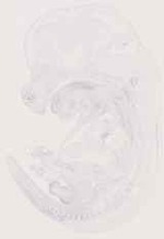 EMAGE:12962