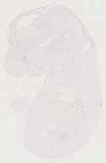 EMAGE:12985