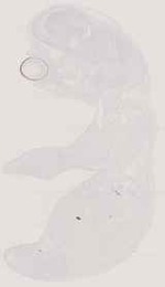 EMAGE:13007
