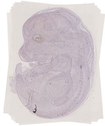 EMAGE:13007
