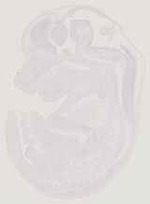 EMAGE:13008
