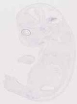 EMAGE:13079