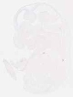EMAGE:13079