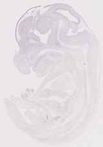 EMAGE:13079