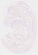 EMAGE:13079