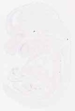 EMAGE:13079