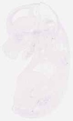 EMAGE:13079
