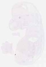 EMAGE:13079