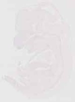 EMAGE:13144