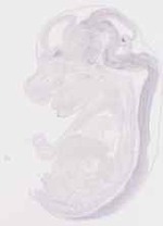EMAGE:13155