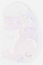 EMAGE:13166