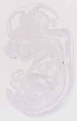 EMAGE:13166