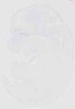 EMAGE:13237