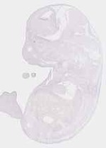EMAGE:13249