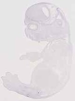 EMAGE:13303