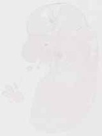 EMAGE:13303