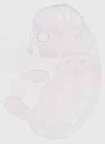 EMAGE:13303