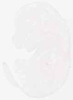 EMAGE:13306