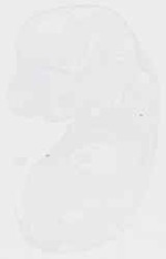 EMAGE:13309