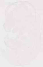 EMAGE:13314