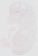 EMAGE:13392