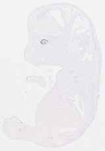 EMAGE:13401