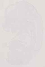 EMAGE:13429