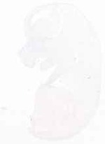 EMAGE:13439