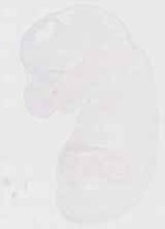 EMAGE:13466