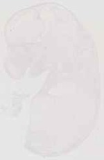 EMAGE:13470