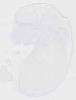 EMAGE:13473