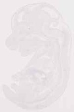 EMAGE:13503